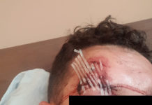 Überfall auf dem Fischmarkt an Altweiber-Fastnacht