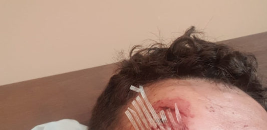 Überfall auf dem Fischmarkt an Altweiber-Fastnacht