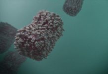 Erster Fall von Affenpocken in der Stadt Worms